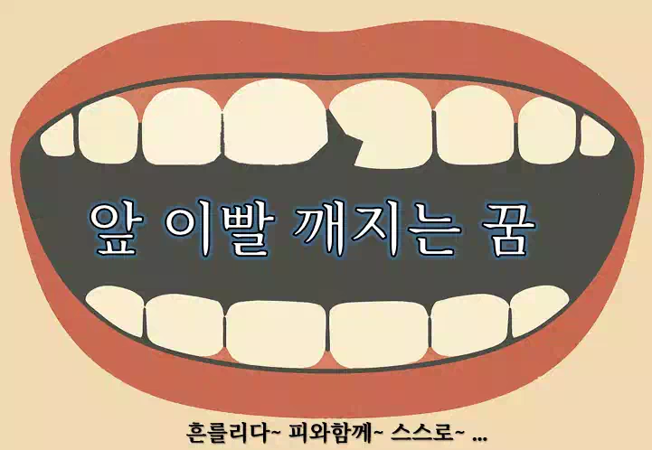 앞 이빨 깨지는 꿈_배너