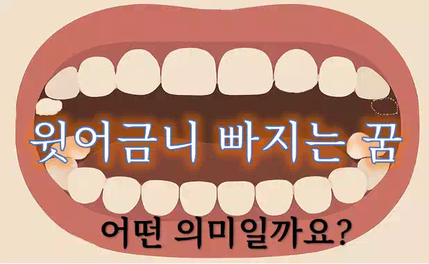 윗어금니 빠지는 꿈_banner